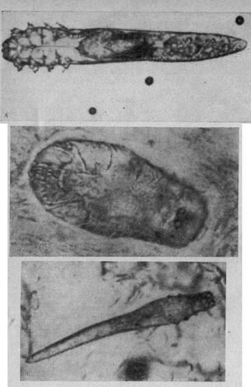 Cicatrice acariforme, paraziți ai corpului uman - ascaride, lamblia, viermi