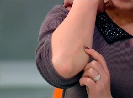Krém „egészséges” - a nyitó a psoriasis kezelésére (pikkelysömör) Cream „egészséges” - a felfedezés a pikkelysömör kezelésében