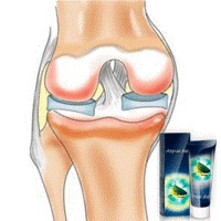 Tratamentul chondromatozelor articulațiilor șoldului, genunchiului, cotului, articulațiilor glezne, articulațiilor dureroase