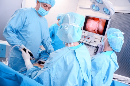 Myoma de chirurgie uterului și tratamentul bolii