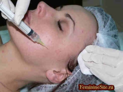 Bazele mezoterapiei în cosmetologia modernă
