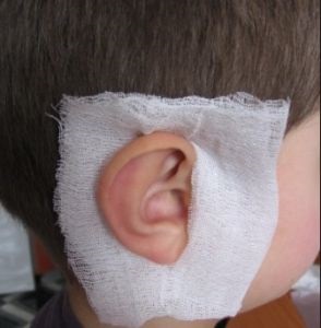 Tratamentul otitei pentru inflamația urechii la adulți