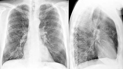 Despre pericolele vopselei de aerosoli