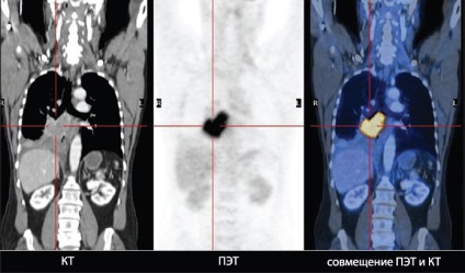 PET CT vizsgálat Szentpéterváron