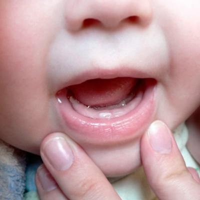 Diaree cu dentiție cât de mult este ținut și ce trebuie tratat