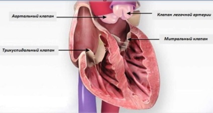 Defectele valvei mitrale, mc intercardio