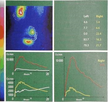 Tomografie cu emisie de pozitroni (animale de companie), diagnostic radioizotopic