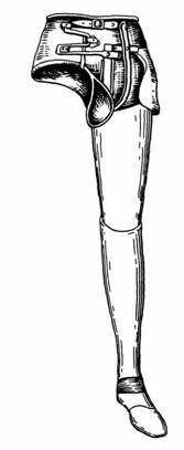 Alsó végtag protézisek (femur, tibia)