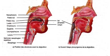 Cancerul laringelui