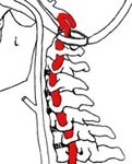 Coloanei vertebrale cervicale, dureri de cap, cauze, dezechilibru - site-ul 