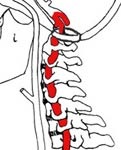 Шийний відділ хребта, головний біль, причини, порушення рівноваги - сайт «ми про здоров'я»