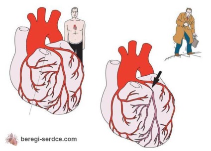 Măsurarea bolii și a bolilor de inimă la diabet zaharat (aritmie, angina pectorală și altele)
