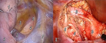 Posibilități moderne de chirurgie toracoscopică în oncologie