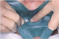 Articole despre endodonție, materiale și echipamente
