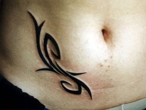 Tatuaj pe cicatrice de la apendicită