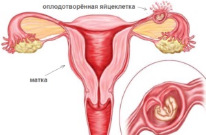 Întreruperea după menstruație (la sfârșitul menstruației, o săptămână mai târziu, în ultimele zile) este maro