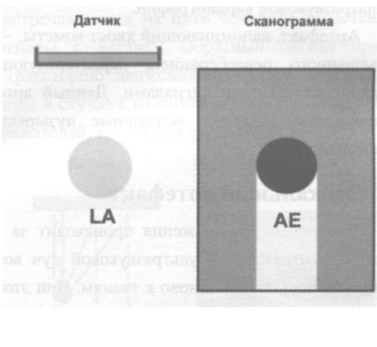 Artefacte cu ultrasunete