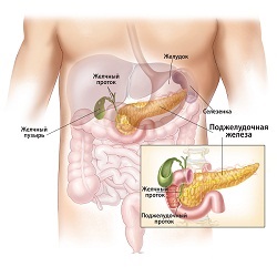 Pancreatită cronică, cum să trateze cauzele pancreasului, simptome, semne, tratament și