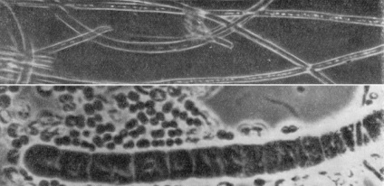 F) ordinea de chlamydobacteria (chlamydobacteriales)