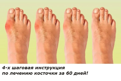 Ismerős tanácsára nagyanyám le a forró tea fej íj! Most a bél működik óramű! (Hagyma) Ismerős tanácsára nagyanyám le a forró tea fej íj! Most a bél működik óramű!