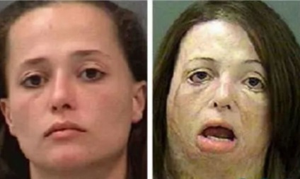 20 fotografii terifiante despre modul în care metamfetamina corodează fața și sufletul - lucruri proaspete