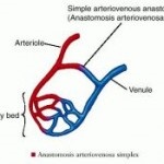 Artevennoze anastomotice, secretele medicinei populare