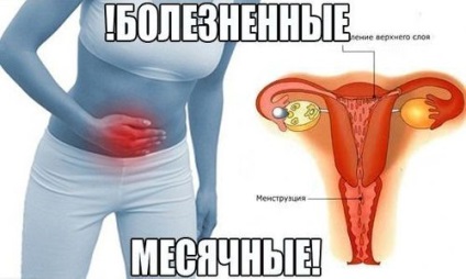 Menstruație dureroasă (dismenoree)