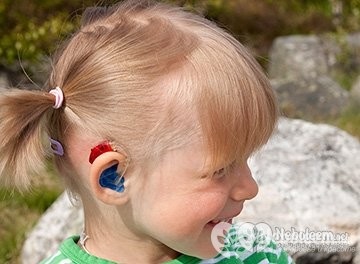 Copii cu deficiențe de auz - educație și reabilitare