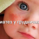 Hajlamosság arca olyan csecsemők kezelésére, kenőcsök és népi jogorvoslati
