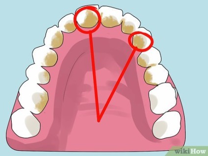 Cum să identificați boala gingiilor