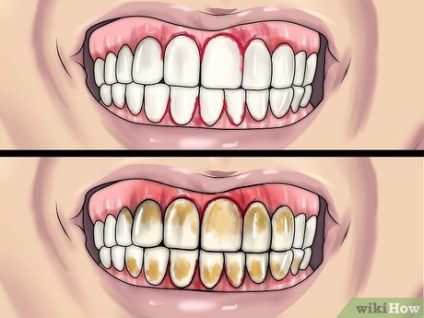 Cum să identificați boala gingiilor
