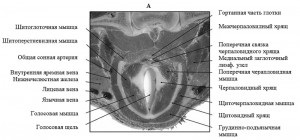 Anatomia computerizato-tomografică a laringelui în rasele de câini mezocefalici