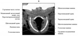 Anatomia computerizato-tomografică a laringelui în rasele de câini mezocefalici