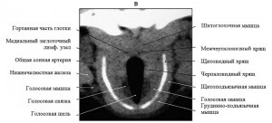 Anatomia computerizato-tomografică a laringelui în rasele de câini mezocefalici