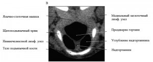 Anatomia computerizato-tomografică a laringelui în rasele de câini mezocefalici