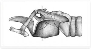 Anatomia computerizato-tomografică a laringelui în rasele de câini mezocefalici