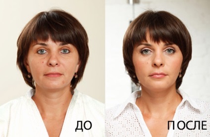 Kontúr (ajak kontúr) kontúr Javítás