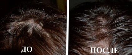 Crioterapia este una din modalitățile de îmbunătățire a capului părului