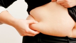 Excesul de greutate și varicoze de ce aveți nevoie pentru a pierde în greutate
