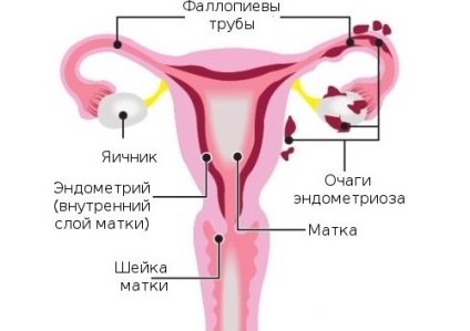 Дали е възможно да се направи Узи месечно