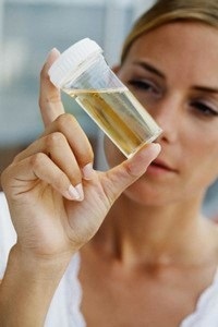 Beneficiile și Harms de urină Terapie