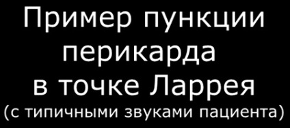 Szívtamponád (szívtamponádot) szívtamponádot