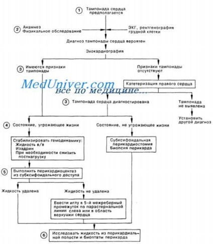 Tamponada cardiacă