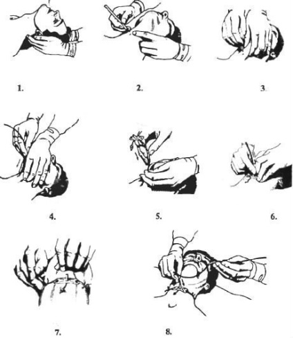 Tehnica conicotomiei (mini-traheostomie)