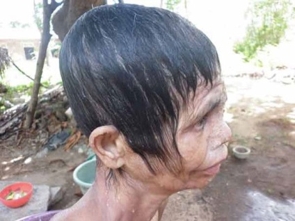 Trópusi fertőzések evett fele az arc lakosok Sri Lanka (fotó), a női magazin onlan