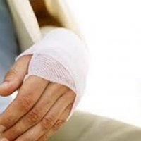Recuperarea după fractura gleznei - bisturiu - informație medicală și portal educațional