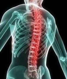 Probleme spinale sănătoase ale coloanei vertebrale și tratamentul acesteia - despre sănătate - catalog de articole - secrete