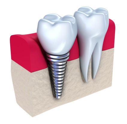 Laborator dentar, centru multidisciplinar de chirurgie ambulatorie