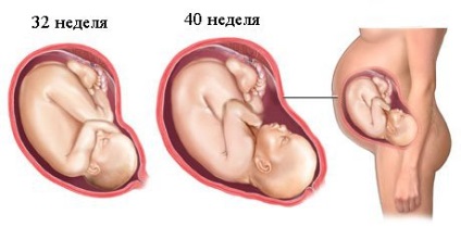 3 Uzi la sarcină - în ce termen faceți sau faceți