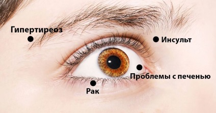 8 Semnale cu care ochii avertizează asupra problemelor de sănătate! Fiți atenți!